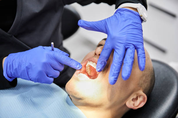 Best Emergency Dentist for Lost Fillings or Crowns in Princevle, IL