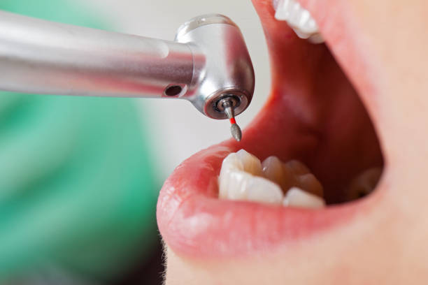 Best Broken or Cracked Tooth Emergency Dentist in Princevle, IL